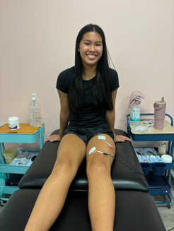 Use of NMES electrical stimulation during ACL rehabilitation